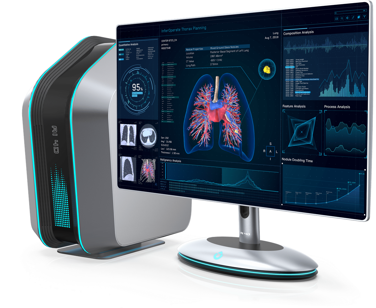 AI-assisted clinical workflow for medical imaging analysis